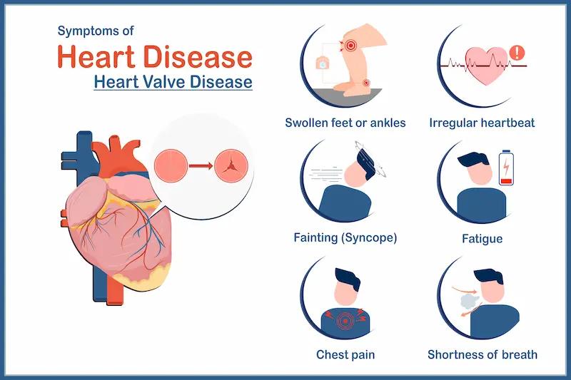Heart Failure Signs