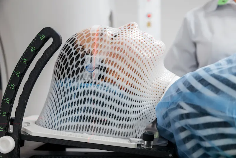 Radiation Therapy for Brain Tumor in Turkey
