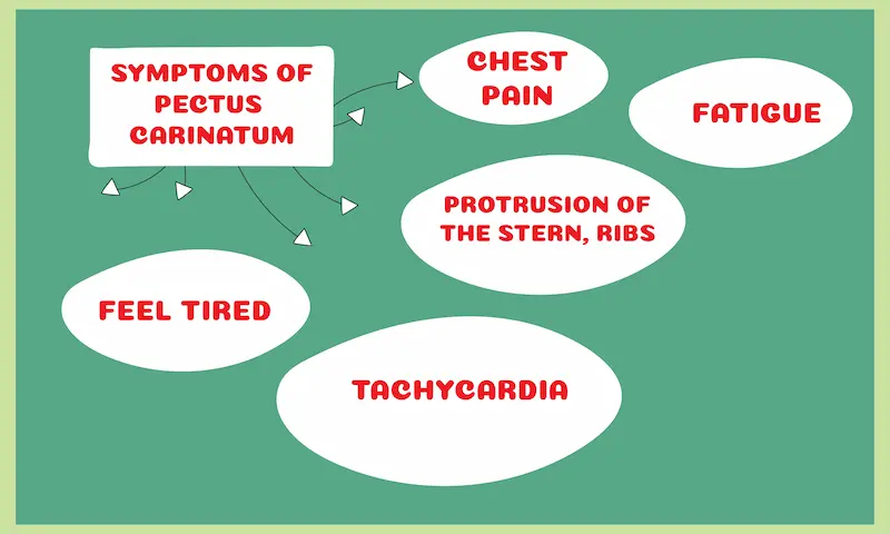 Symptoms of Pectus Carinatum