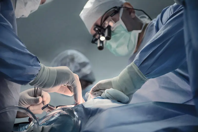 Team of Surgeons Performing Heart Transplant Operation in Turkey