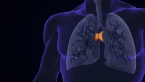 Thymoma Surgery in Turkey