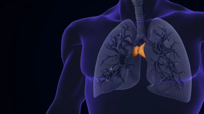 Thymoma Surgery in Turkey
