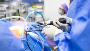 Arthroscopic Surgery in Turkey