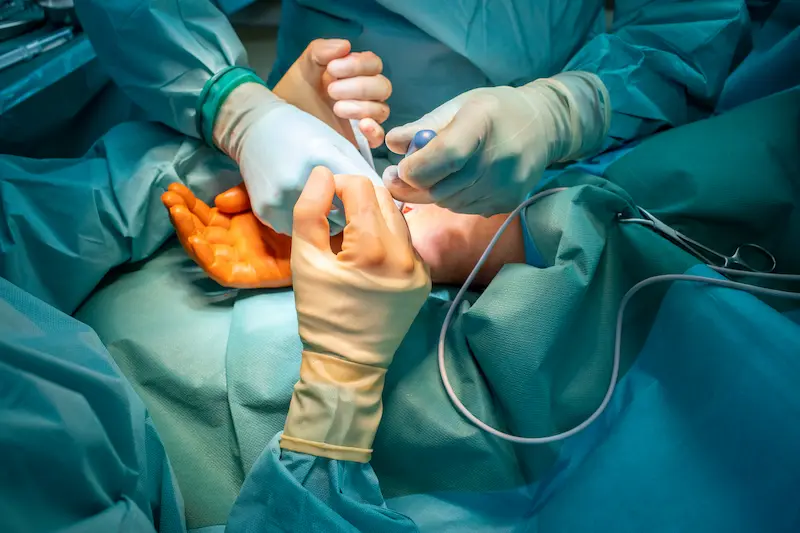 Carpal Tunnel Release Surgery