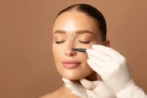 دليل شامل لجراحة تجميل الأنف بتقنية التدحرج في تركيا