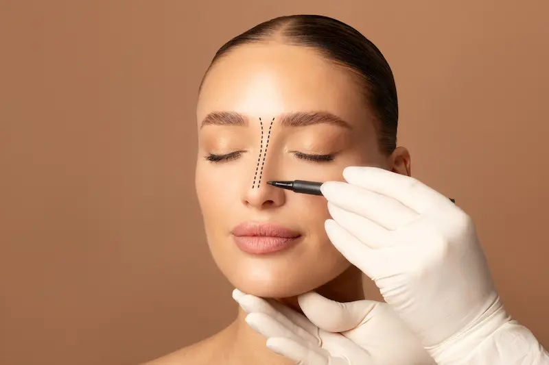 تجميل الأنف (ليبت داون والمغلق)