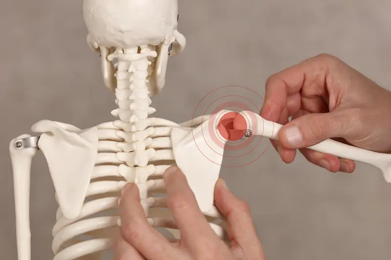 How to Prevent Shoulder Replacement