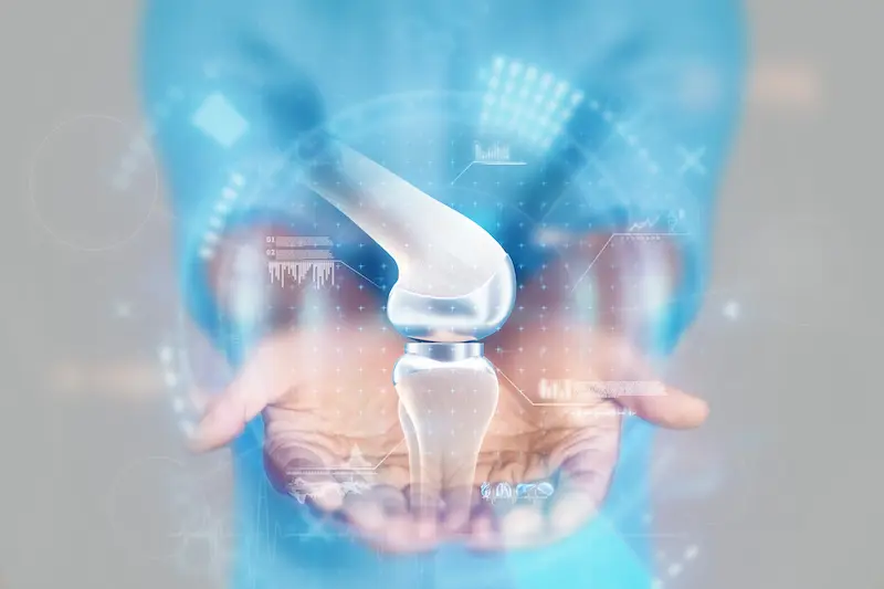 Knee Replacement in Turkey