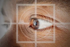 Lasik Eye Surgery in Turkey