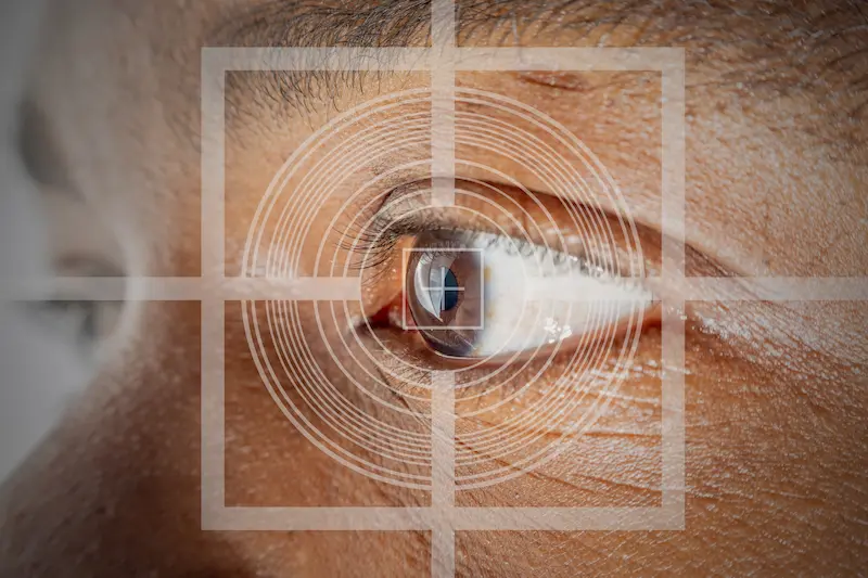 Lasik Eye Surgery in Turkey
