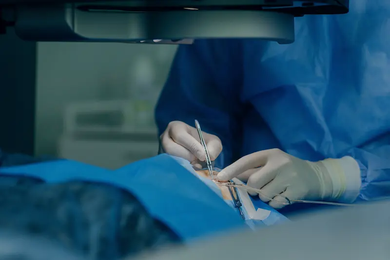Lasik Laser Eye Surgery