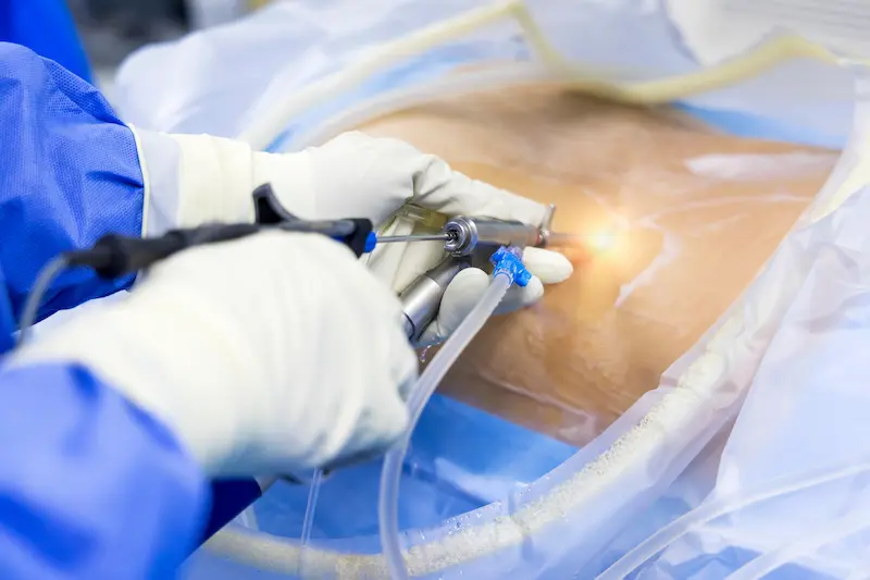Spinal Surgery in Turkey