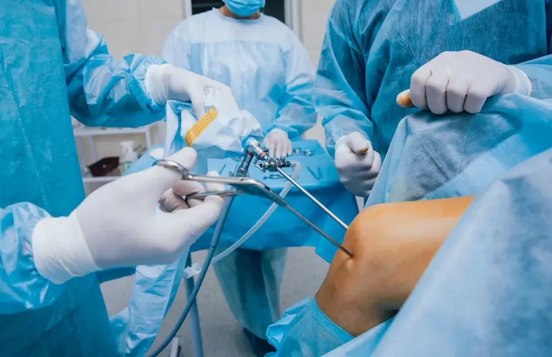 Types of Arthroscopic Surgery