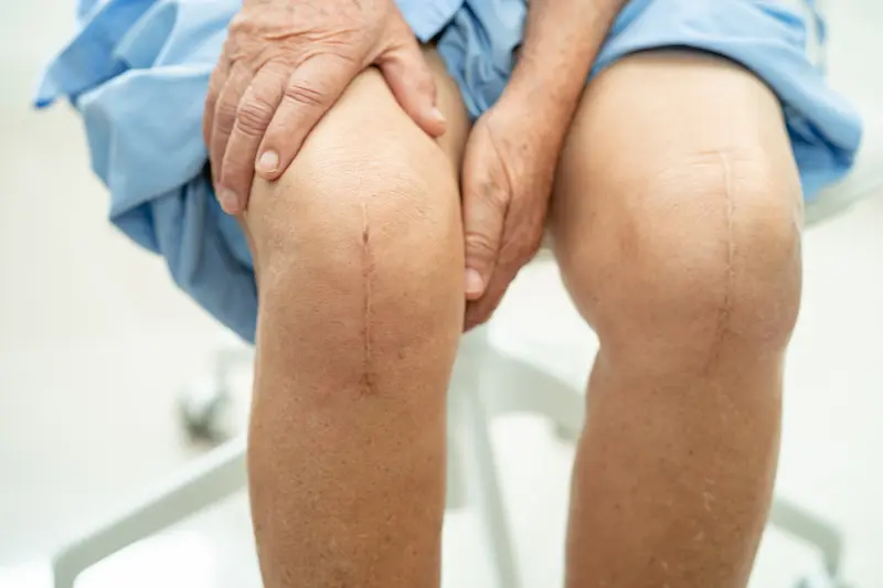 Types of Knee Replacement