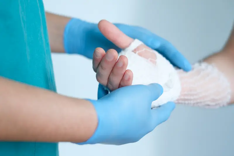 Wrist Surgery Cost Turkey