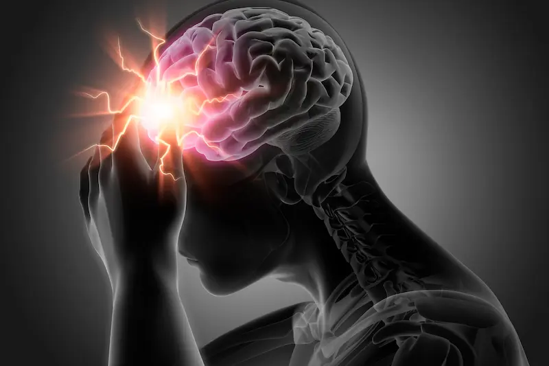 Brain AVM Treatment in Turkey
