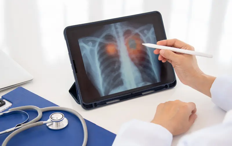 Doctor Consultation Before Lung Tumor Surgery in Turkey