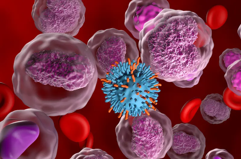 Lymphoma Chemotherapy in Turkey