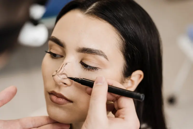 Rhinoplasty in Turkey