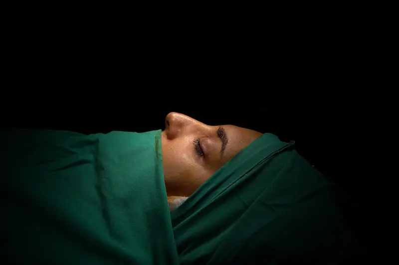 Rhinoplasty Noses