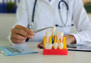best dental clinic turkey
