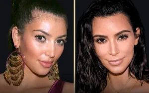 Kim Kardashian Before Plastic Surgery