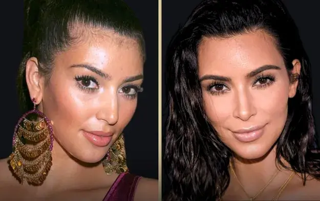 Kim Kardashian Before Plastic Surgery