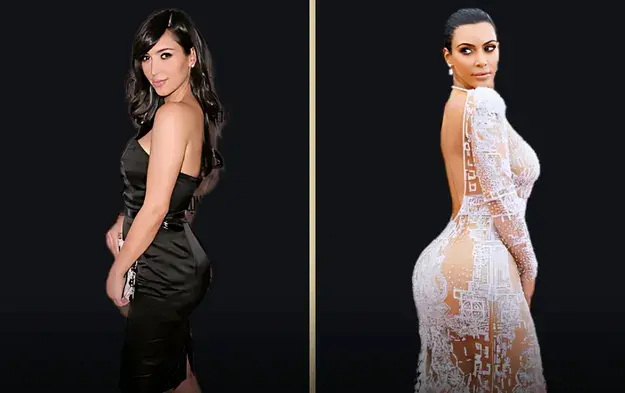 Kim Kardashian Plastic Surgery