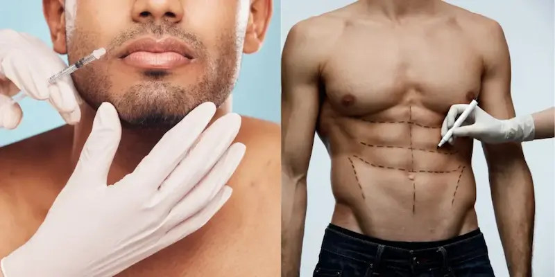 Male Plastic Surgery Reviews