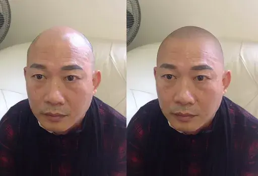 Smp Before - After