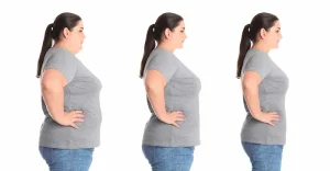 bariatric surgery cost turkey