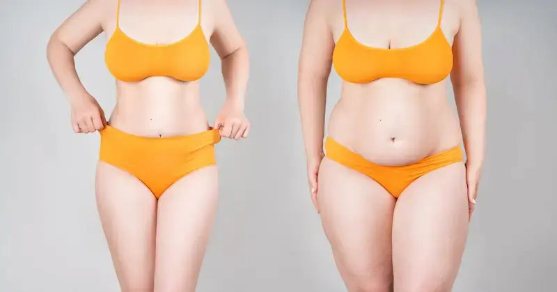 Gastric Bypass Cost Turkey