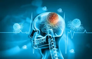 brain tumor surgery in Turkey
