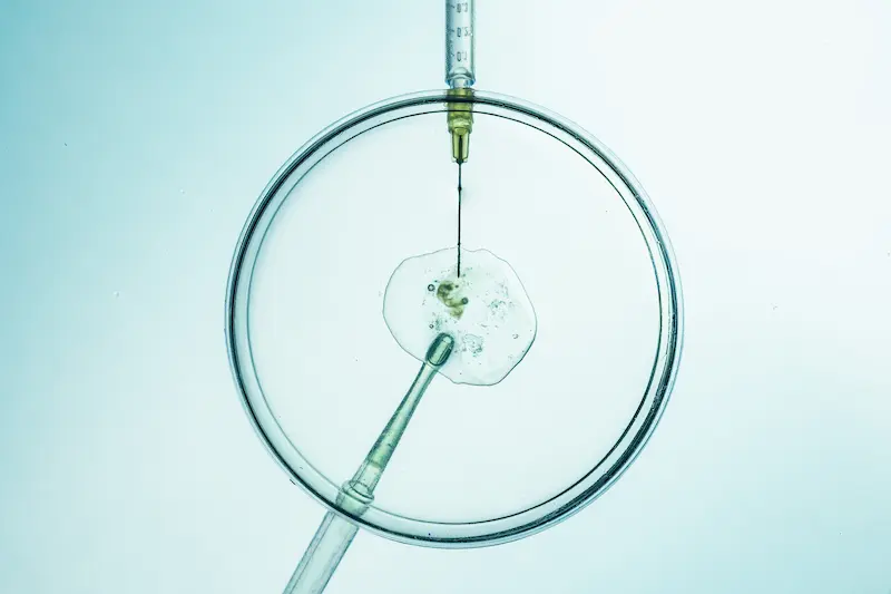 The Cost of IVF Treatment in Turkey: A Full Breakdown of Expenses