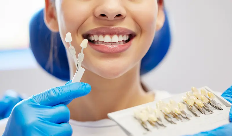 how to choose the perfect veneer