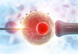 IVF success rates in Turkey