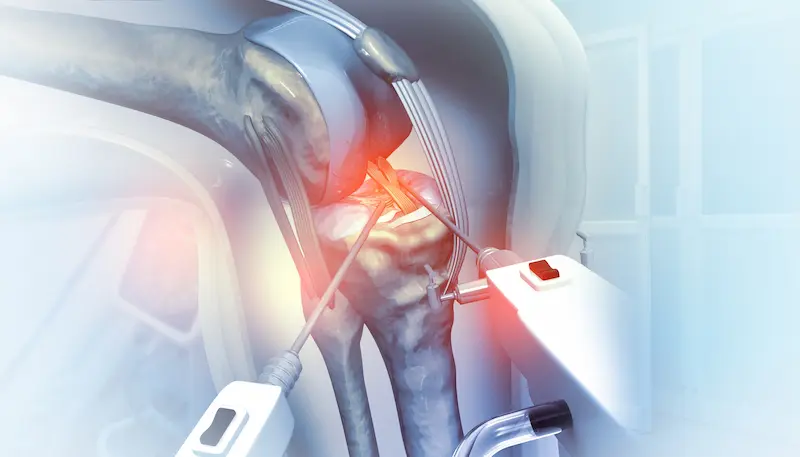 knee replacement surgery in Turkey