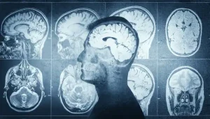 read brain MRI report