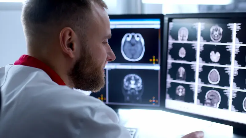 What Happens After Your Brain MRI?